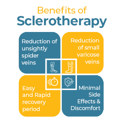 Piles Sclerotherapy