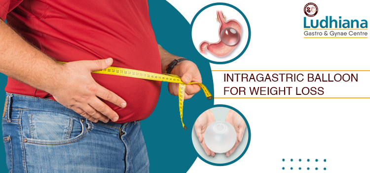 Intragastric Balloon For Instant Weight Loss