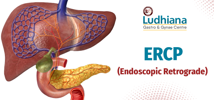 ERCP (Endoscopic Retrograde