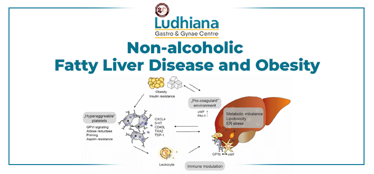 Non-alcoholic-Fatty-Liver-Disease-and-Obesity