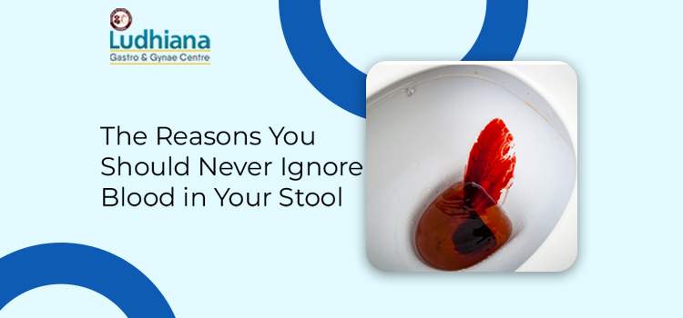 Blood In Stool Treatment in Ludhiana | Treatment for Rectal bleeding in
