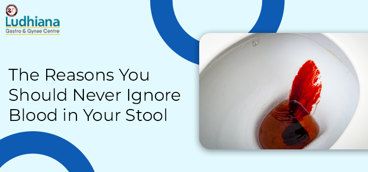The Reasons You Should Never Ignore Blood in Your Stool