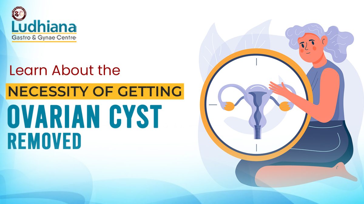 Exploring the Necessity of Ovarian Cyst Removal: Debunking Myths