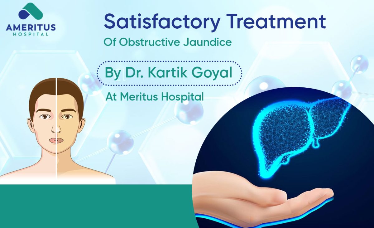 Satisfactory Treatment Of Obstructive Jaundice By Dr Kartik Goyal At Meritus Hospital